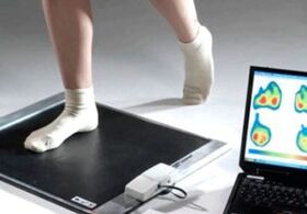 Диагностика на халукс валгус