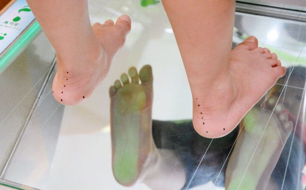 Плантография